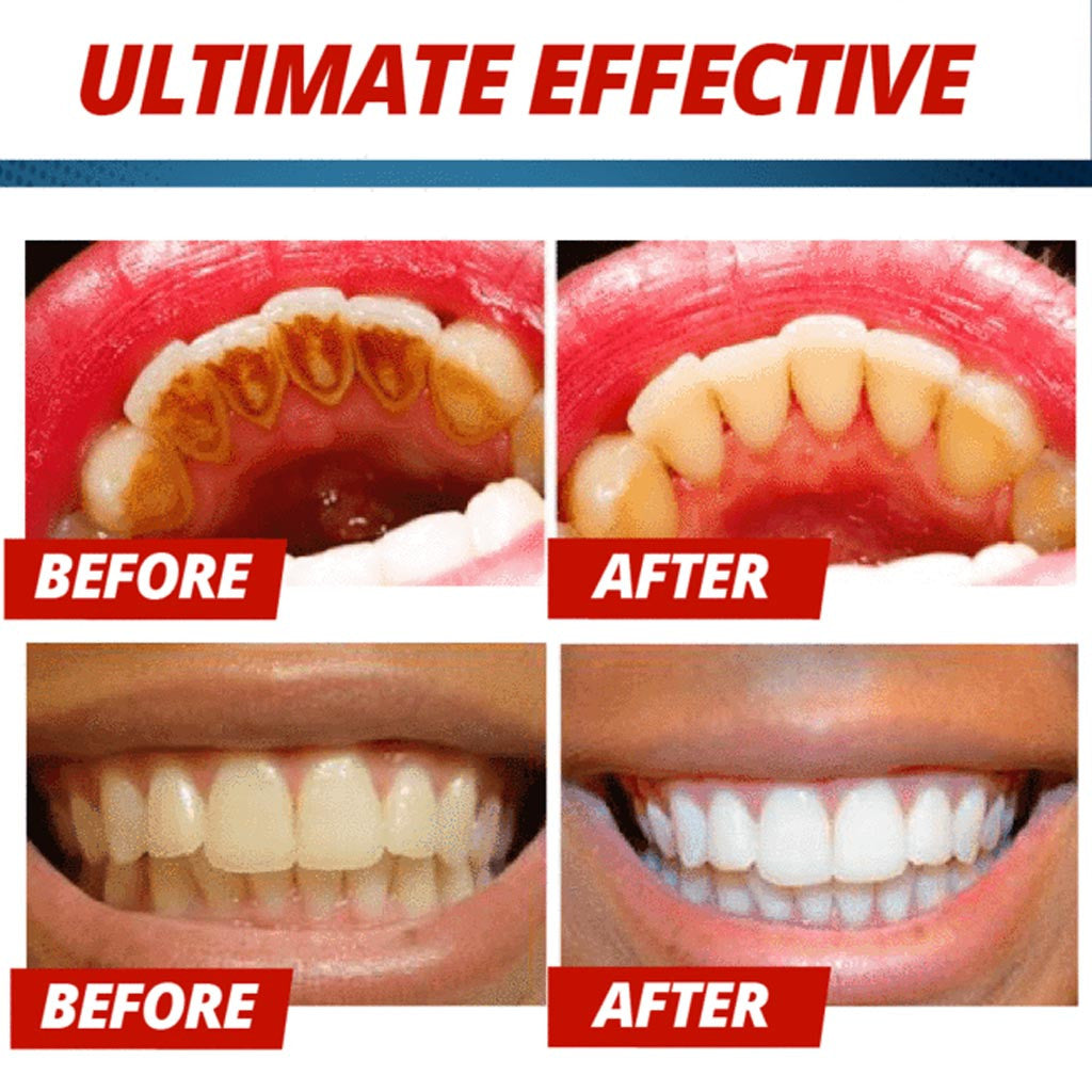 Magical Soda Whitening Toothpaste Teeth Whitening